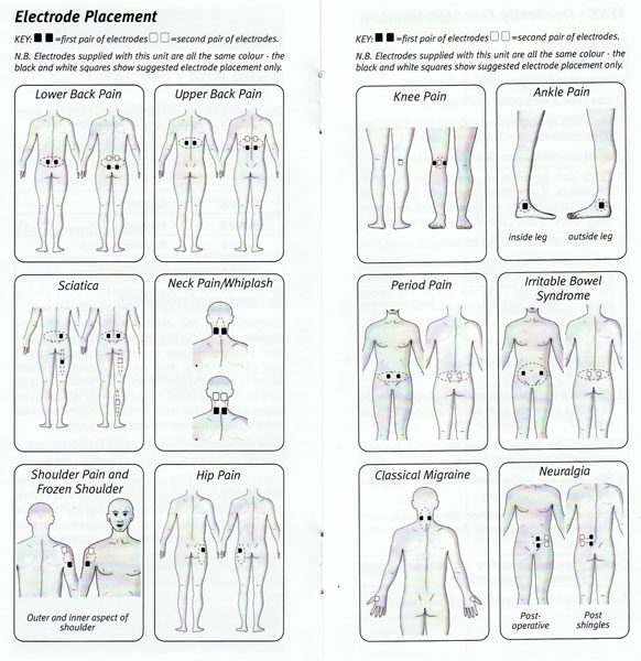 Tens Placement Chart Sciatica