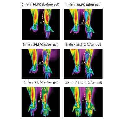 Image of Biofrost Active infrared thermography