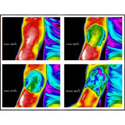 Image of BIOFROST Relief thermography studies