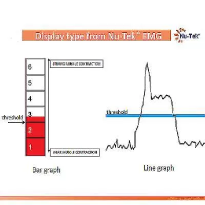 Image of EMG images
