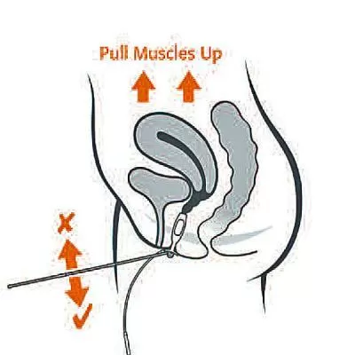 Image of Periform Plus with indicator wand inserted 
