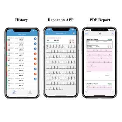 Image of smartphone screens with ECG waveforms